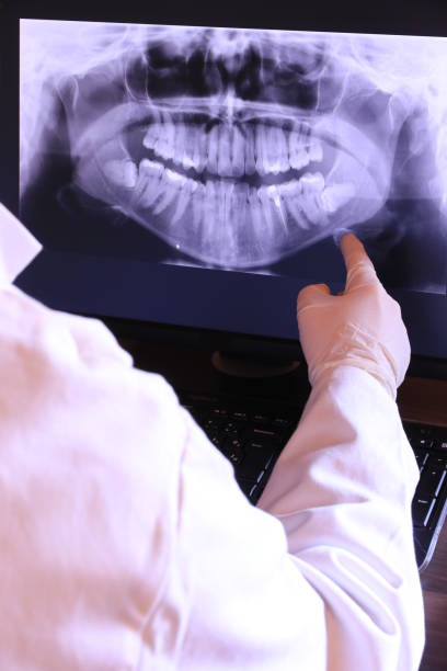 Best Emergency Treatment for Dental Infections or Abscesses in Brookfield Center, OH