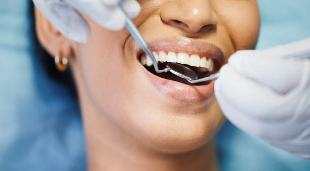 Best Emergency Dental Care for Broken or Chipped Teeth in Brookfield Center, OH
